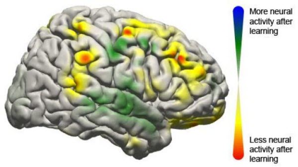 Brain Computer Interface